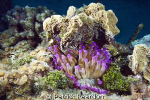 Anemone, Cracked Conch shore dive, Grand Cayman. by Patrick Reardon 